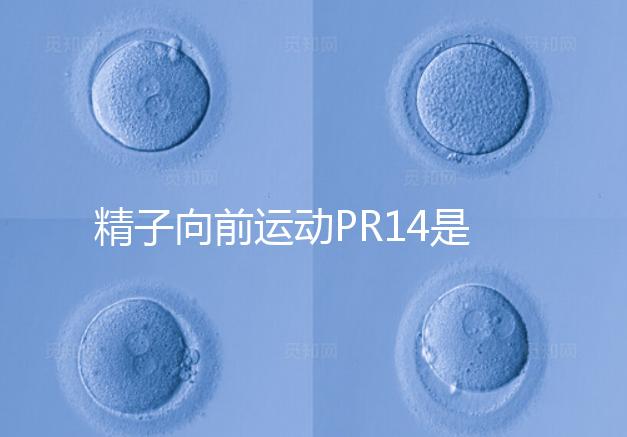 精子向前運(yùn)動PR14是否正常聽專家怎么說，當(dāng)心弱精找上門