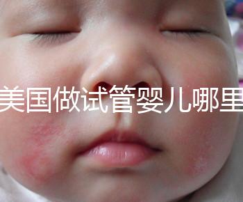 去美國做試管嬰兒哪里最好，4家好評輔助生殖機構推薦