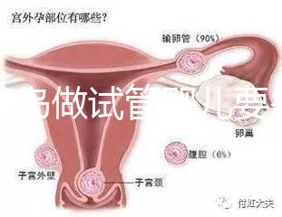 去青島做試管嬰兒要多少錢？