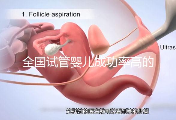 全國試管嬰兒成功率高的醫(yī)院有哪些？（全國試管嬰兒成功率高的醫(yī)院目錄一覽）
