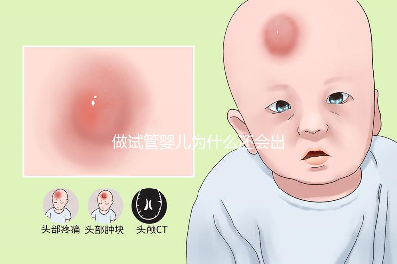 做試管嬰兒為什么還會(huì)出現(xiàn)宮外孕？如何避免下次宮外孕？