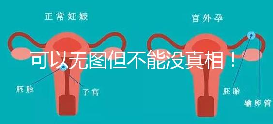 可以無圖但不能沒真相！段濤大夫帶你了解B超檢查報告單