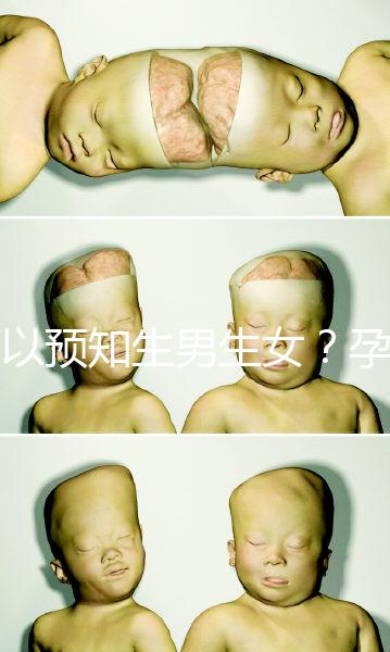 可以預(yù)知生男生女？孕婦夢見馬的胎夢解讀