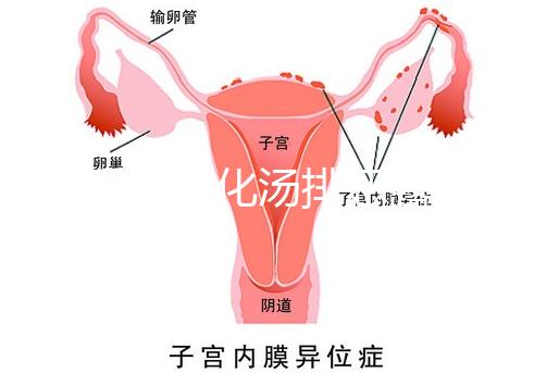 產(chǎn)后喝生化湯排惡露會(huì)使寶寶拉肚子？醫(yī)生：時(shí)間沒用對