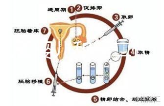 代試管嬰兒和第二代試管嬰兒的區(qū)別，基因篩查技術！