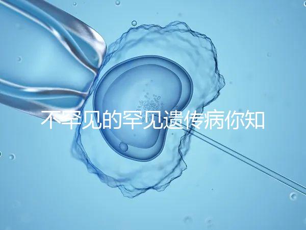 不罕見的罕見遺傳病你知道嗎？帶你認識下特納綜合癥