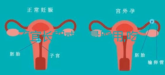 不宜長(zhǎng)期或過(guò)量服用,吃DHEA要注意這3點(diǎn)