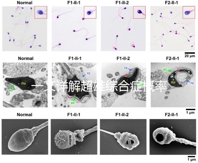 一文詳解超雄綜合癥概率有多大，想造的人多不多看過來