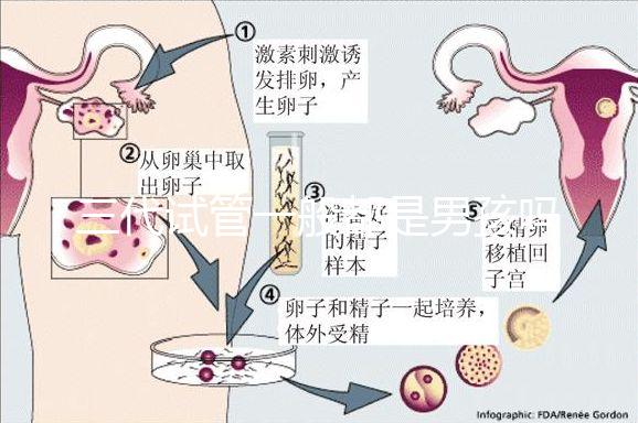 三代試管一般都是男孩嗎（三代試管一般都是男孩嗎還是女孩）