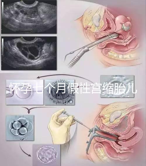 懷孕七個(gè)月假性宮縮胎兒可能缺氧，處理不好對(duì)胎兒影響大