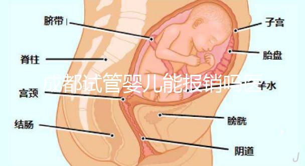 成都試管嬰兒能報銷嗎醫保？政策解讀