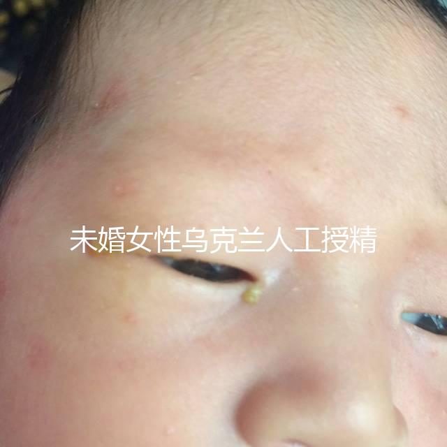 未婚女性烏克蘭人工授精必看！醫(yī)療及生活費用明細預覽