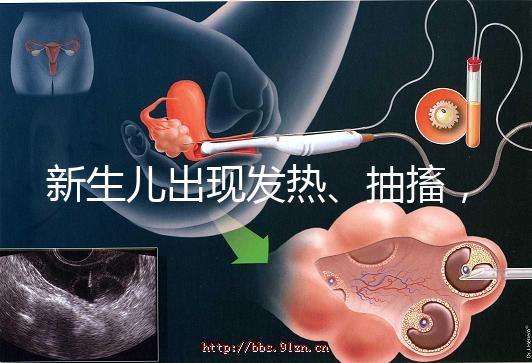 新生兒出現發熱、抽搐，很可能是胎毒的表現