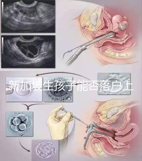 新加坡生孩子能否落戶上海分，@家長:高學歷可以申請