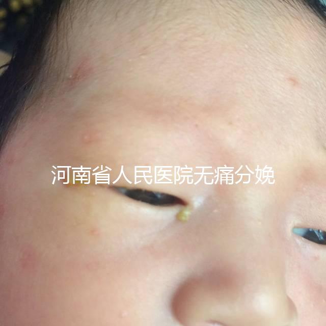 河南省人民醫(yī)院無痛分娩多少錢戳，收費標準60s看懂不踩坑