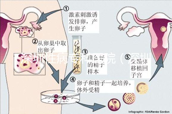 深圳性病?？漆t院（深圳hpv病毒治療中心）