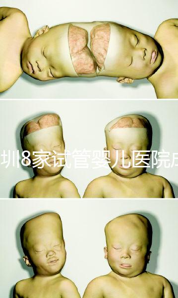 深圳8家試管嬰兒醫院成功率排名，供卵、供精首選各不同