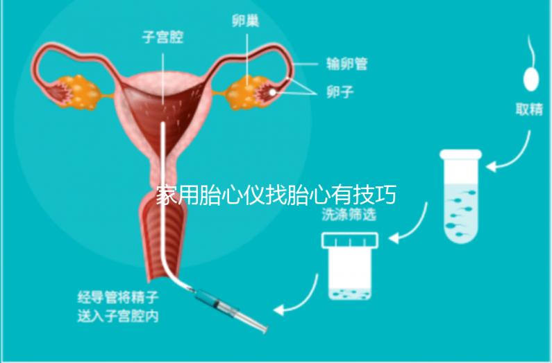 家用胎心儀找胎心有技巧，飯后半個(gè)小時(shí)測(cè)準(zhǔn)確率稍高