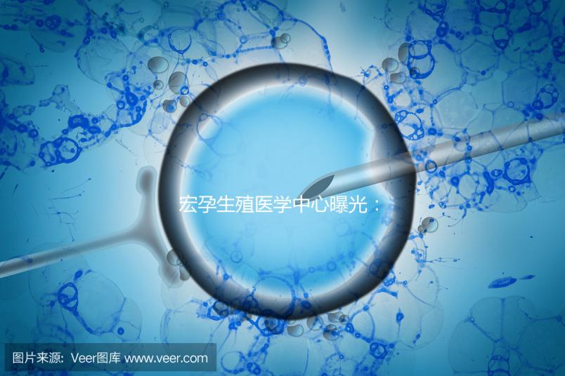 宏孕生殖醫學中心曝光：PGD成功率及適用人群