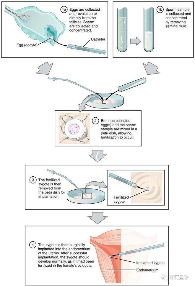 婦科病癥狀（婦科病癥狀表現有哪些呢）
