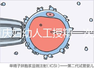 重慶婦幼人工授精一次成功率揭秘，移植費用貴有原因