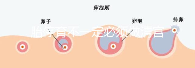 胎停育不一定必須做清宮！不滿足這3種情況,無(wú)需要刮宮