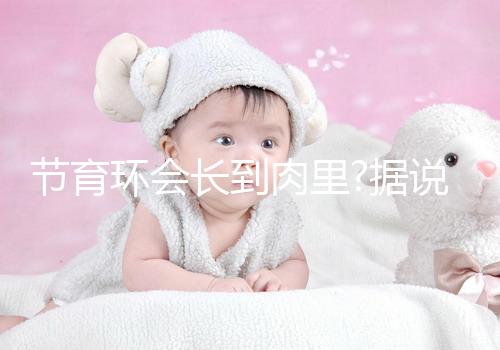 節(jié)育環(huán)會(huì)長到肉里?據(jù)說這是有一定依據(jù)的