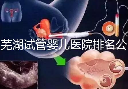蕪湖試管嬰兒醫(yī)院排名公開(kāi)，弋磯山醫(yī)院、蕪湖二院獲好評(píng)