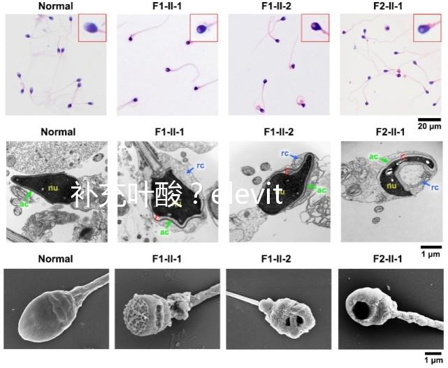 補(bǔ)充葉酸？elevit愛(ài)樂(lè)維那你不得不了解