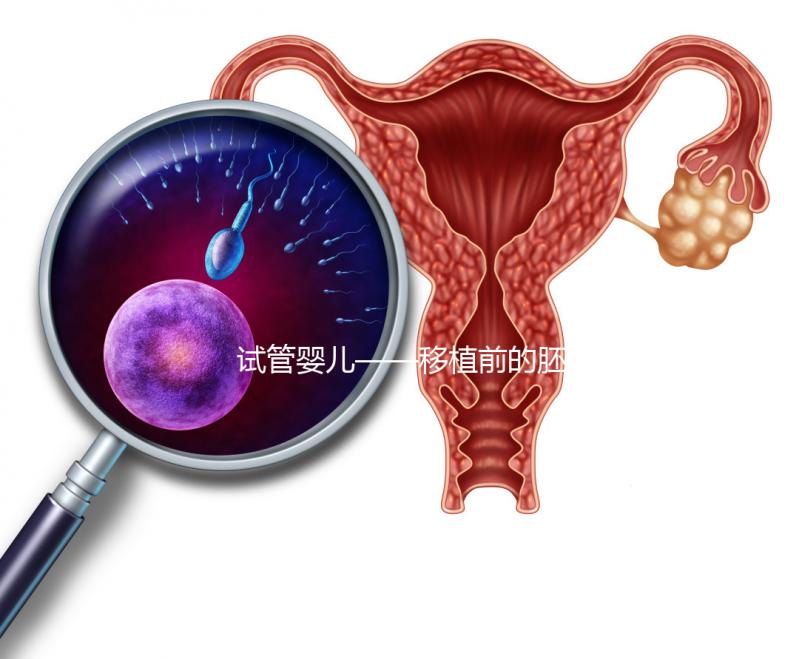 試管嬰兒——移植前的胚胎選擇！