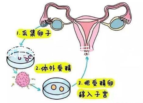 試管嬰兒二超后減藥原因已找到，對胎兒沒影響別瞎擔(dān)心