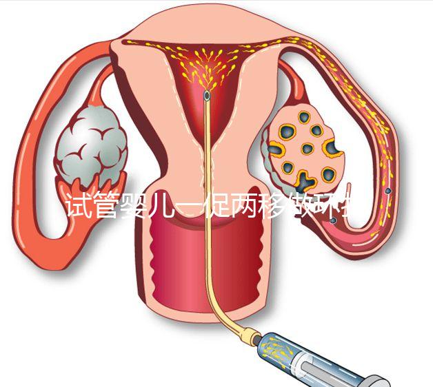 試管嬰兒一促兩移做環扎好看嗎？小心這些影響