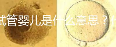試管嬰兒是什么意思？什么是試管嬰兒？