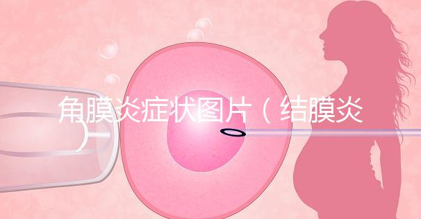 角膜炎癥狀圖片（結膜炎和角膜炎的區別）