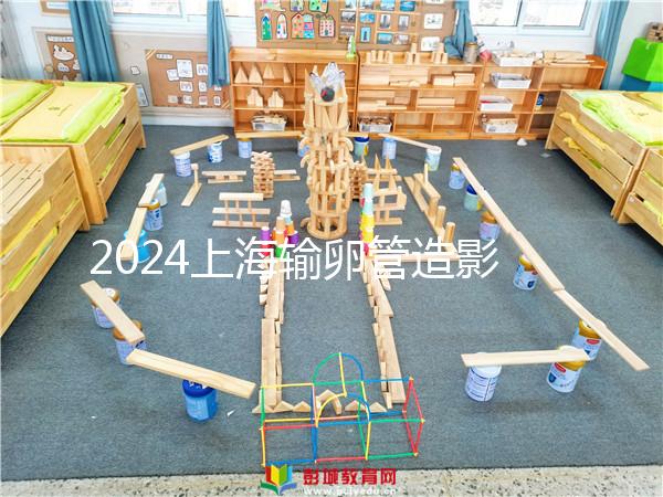 2024上海輸卵管造影檢查多少錢速覽，關(guān)鍵看能否報(bào)銷