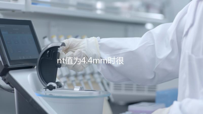 nt值為4.4mm時很危險，及時羊穿確認胎兒畸形很重要