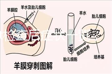 tct檢查后癥狀一覽，專家提醒做好處理措施是關鍵